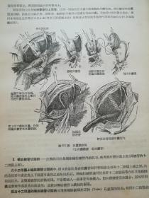 外科解剖学，精装