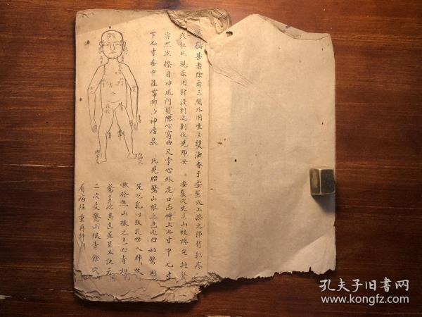 中医推拿药医书古书：清早期精美抄本《推拿要诀》一册全（书下方有伤字，书后有缺页情况） 附图 精美 幼科三种之一 幼科秘书推拿广义 小儿推拿方脉活婴秘旨全书 育婴堂第一善本 小儿推拿书小儿推拿广意小儿中医推拿推拿指法 推拿图极多中医文献初学中医药必备知识 中医入门中医启蒙经典 少见