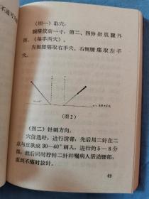 69年南京军区司令部门诊部，《新医疗法介绍》内部学习参考资料，32开本没有残缺破损