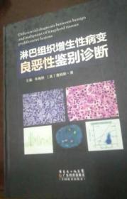 淋巴组织增生性病变良恶性鉴别诊断