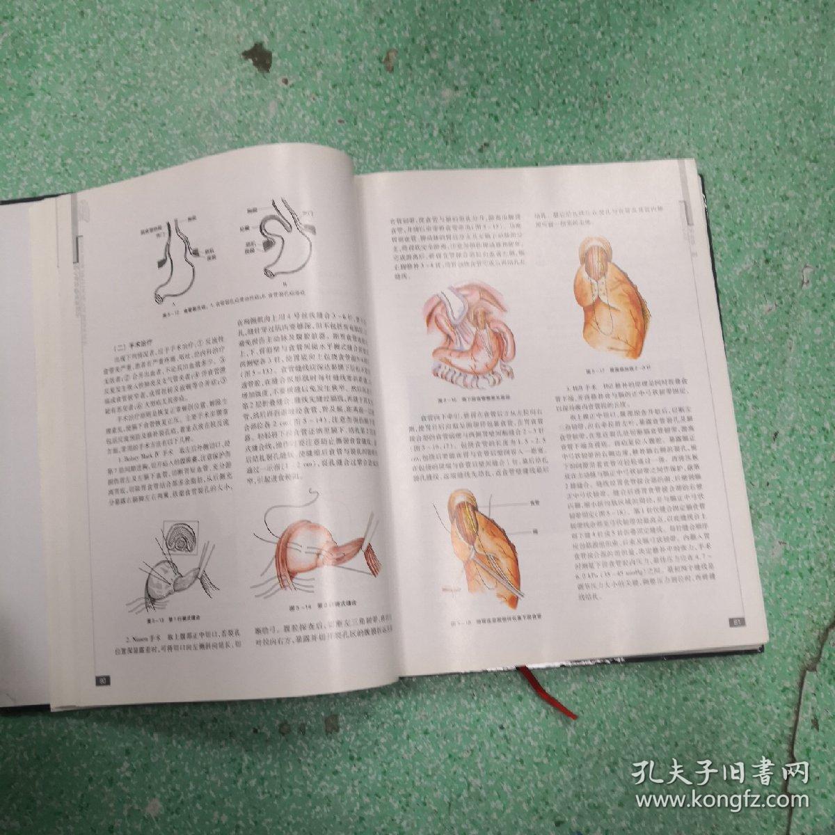 胸心外科临床解剖学书脊有伤看图。