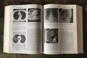 Harris & Harris’ Radiology of Emergency Medicine