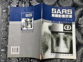 SARS胸部影像图谱