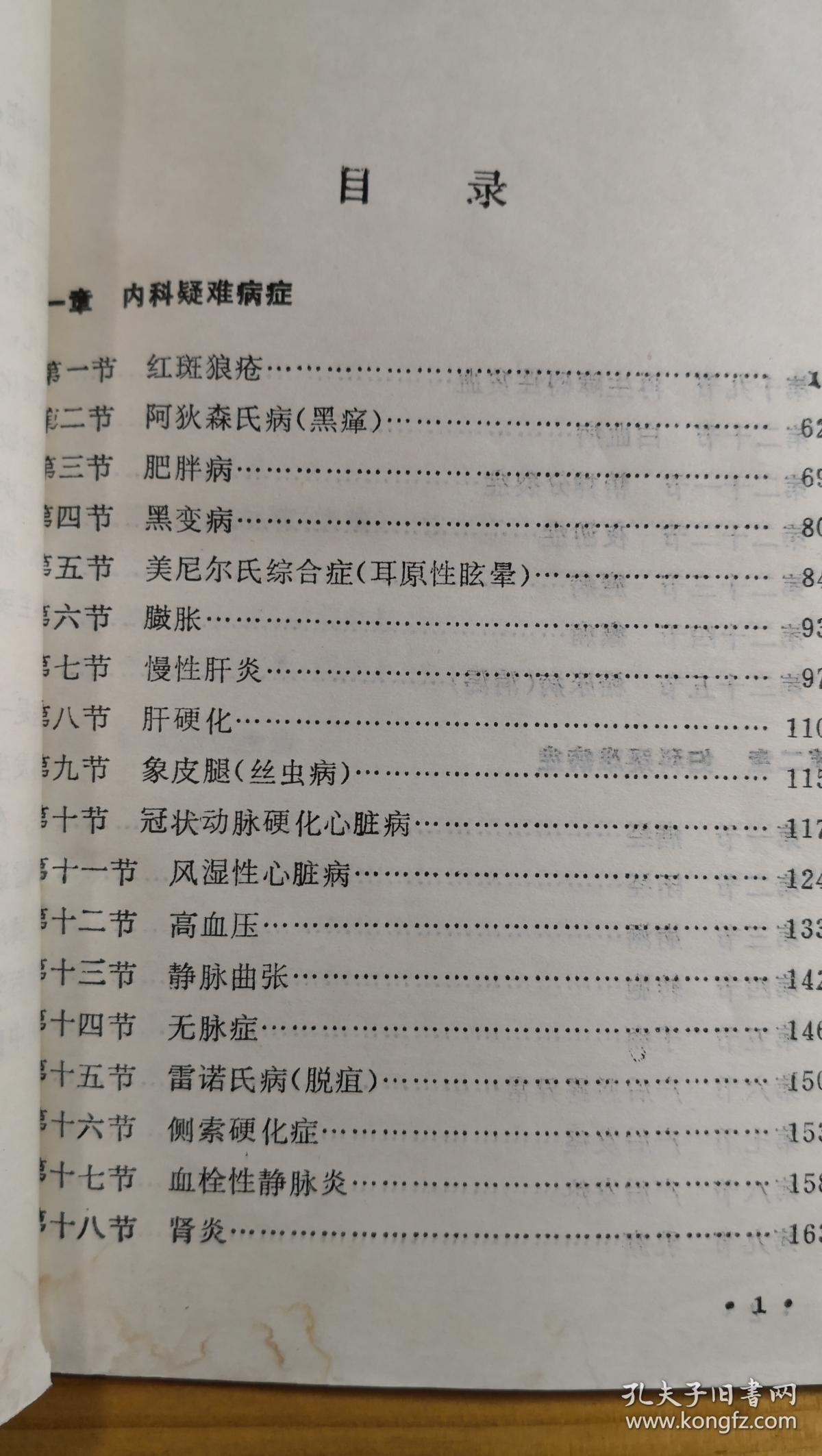 川棉一厂一女工患眼底血管硬化出血，左眼视力仅见手指，来就诊。我望见她步履蹒跚，问「关节痛否?」答以「剧痛」。查血沉为140毫米。我就断定她的病本是风湿，失明只是病标。治标既无效，就应转而治本。于是毅然放弃眼科方剂，主独活寄生汤加蜈蚣、乌梢蛇、仙鹤草、麝香以祛风化湿、活血通络化瘀，结果病人两周即视力复旧，以后历七年而未发此类病症-红斑狼疮，阿狄森氏病，肝硬化等四十七种疑难病—王渭川疑难病症治验选