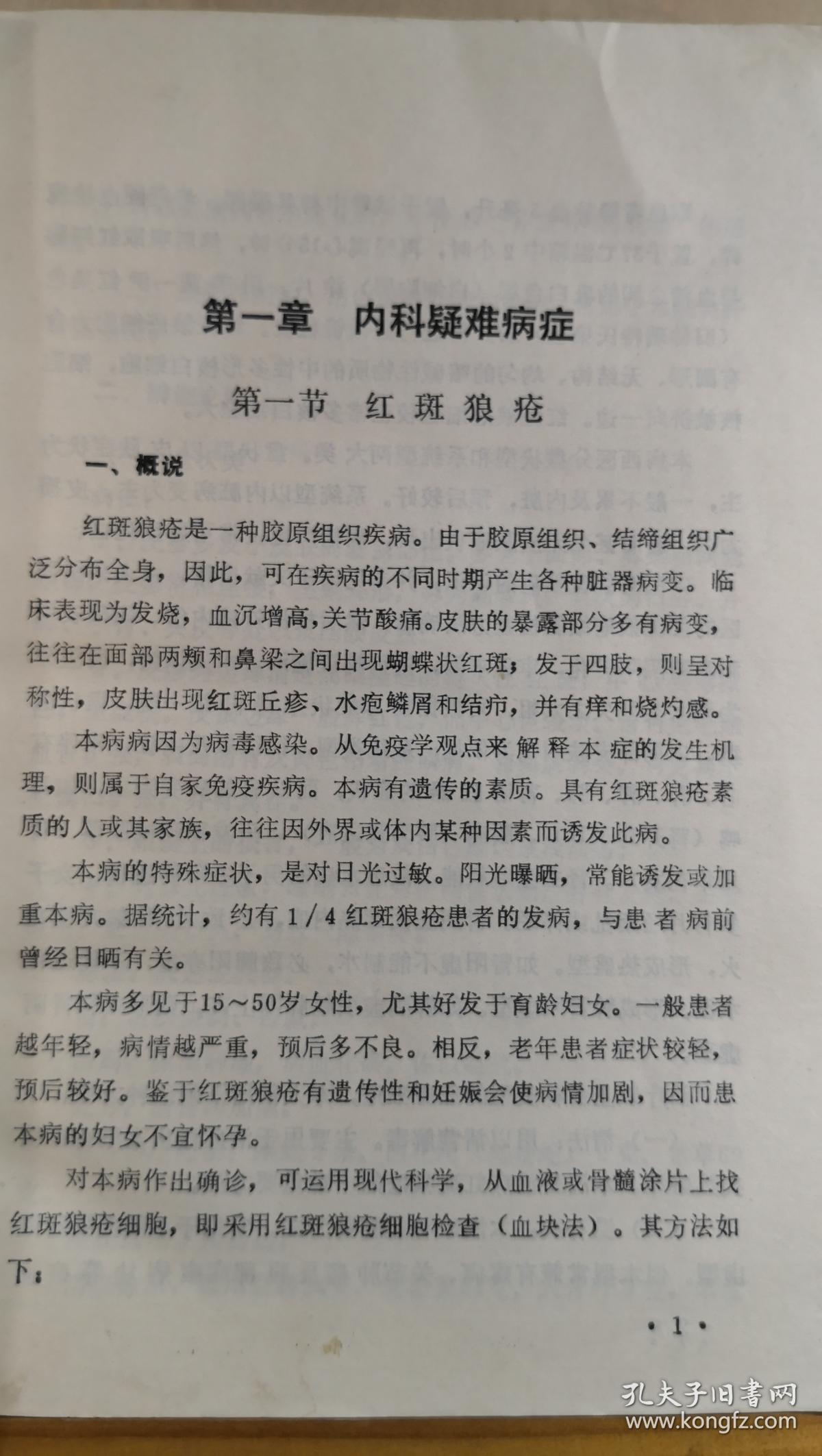 川棉一厂一女工患眼底血管硬化出血，左眼视力仅见手指，来就诊。我望见她步履蹒跚，问「关节痛否?」答以「剧痛」。查血沉为140毫米。我就断定她的病本是风湿，失明只是病标。治标既无效，就应转而治本。于是毅然放弃眼科方剂，主独活寄生汤加蜈蚣、乌梢蛇、仙鹤草、麝香以祛风化湿、活血通络化瘀，结果病人两周即视力复旧，以后历七年而未发此类病症-红斑狼疮，阿狄森氏病，肝硬化等四十七种疑难病—王渭川疑难病症治验选