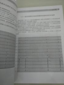 12导同步动态心电图解读