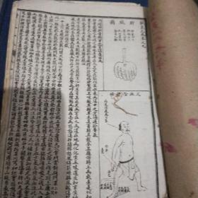 针灸大全  第二卷   第五卷