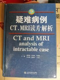 疑难病例CT ，MRI读片解析