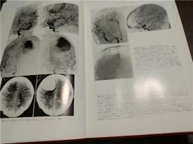 日本日文原版书 神经放射線学Ⅱ 牧丰 久留裕编集 朝仓书店 1979年 16开硬精装