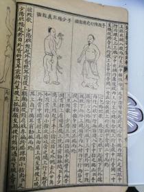 《全图足本医宗金鑑》卷一、卷二合订1册，有多幅中医上的人物图。