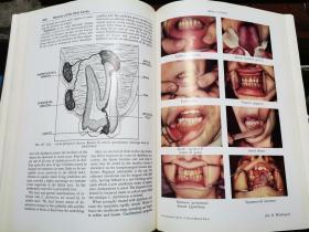 DIAGNOSIS IN DAILY PRACTICE    (日常诊断 )1947年英文原版铜版精装   16开  北京秀鹤图书馆代售       【（医学教授 马万森签名藏书）