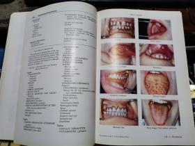 DIAGNOSIS IN DAILY PRACTICE    (日常诊断 )1947年英文原版铜版精装   16开  北京秀鹤图书馆代售       【（医学教授 马万森签名藏书）