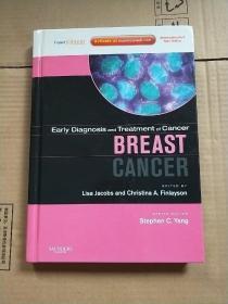 Early Diagnosis and Treatment of Cancer Series: Breast Cancer癌症的早期诊断系列:乳腺癌