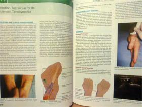 英文原版    Atlas of Pain Management Injection Techniques (Fourth Edition)     疼痛管理注射技术图集