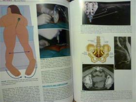 英文原版    Atlas of Pain Management Injection Techniques (Fourth Edition)     疼痛管理注射技术图集