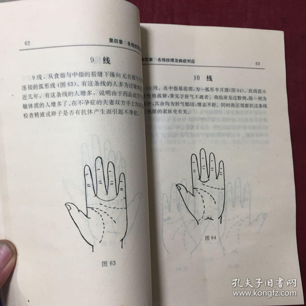 现代掌纹诊病