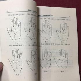 现代掌纹诊病