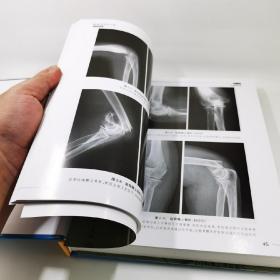 骨关节创伤X线诊断图谱（第3版）