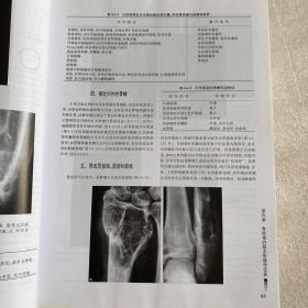 骨与软组织肿瘤