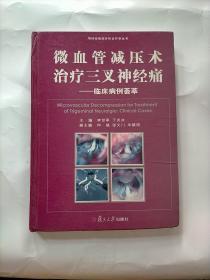 微血管减压术治疗三叉神经痛：临床病例荟萃