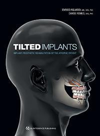 Tilted Implants:牙医 倾斜植入物：萎缩性患者的植入物修复现货