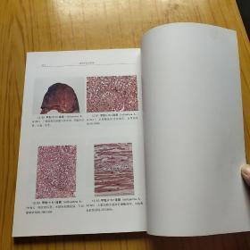 病理学彩色图谱.增订3版