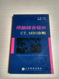 颅脑综合征的CT、MRI诊断