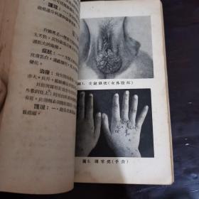 内科学个内科护理（增订版） 戴自英主编 1953年上海广协书局出版