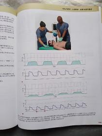 高级心血管生命支持