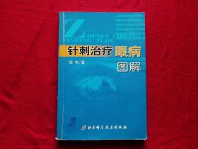 针刺治疗眼病图解（2005年一版一印，覆膜本）