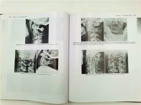 Atlas of Normal Roentgen Variants That May Simulate Disease