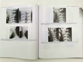 Atlas of Normal Roentgen Variants That May Simulate Disease