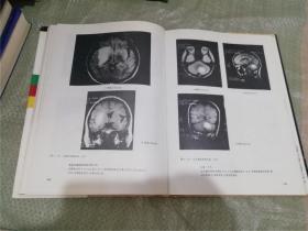神经系统MR诊断图谱