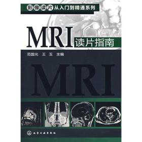 影像读片从入门到精通系列：MRI读片指南