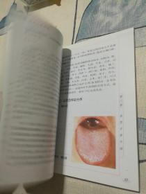 望舌识病图谱