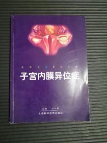 子宫内膜异位症/现代医学研修系列