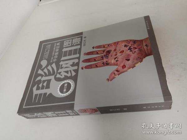 手诊纲目图谱（修订版）