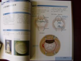 青光眼手术图谱