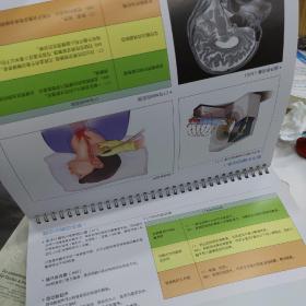 脑卒中医患沟通图谱王拥军正品科普防护手册医患沟通工具口袋书