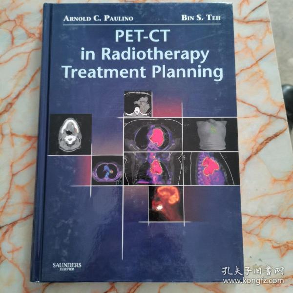 PET-CT in Radiotherapy Treatment Planning