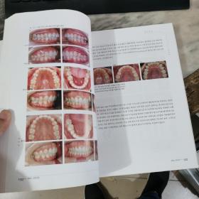 韩文版 牙科书