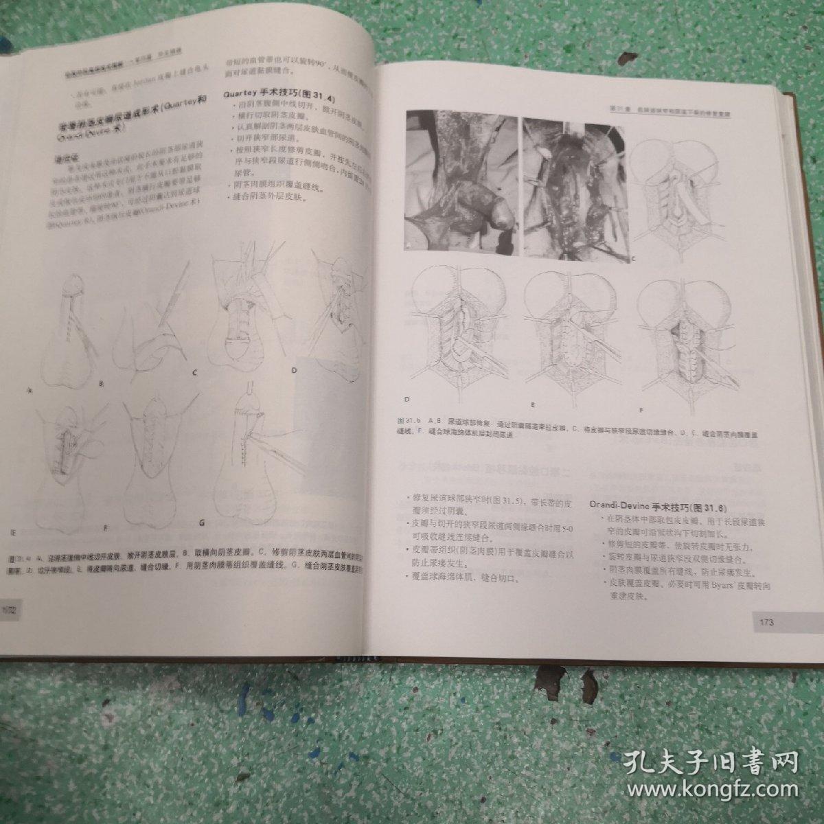 泌尿外科高级技术图解（第3版）书脊有伤看图