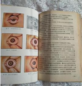 眼科手册［32开,硬精装］附彩页插图