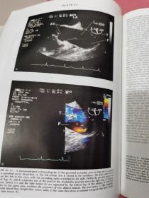 HEART DISEASE A Textbook of Cardiovascular Medicine 5TH EDITION 心血管医学教材第五版