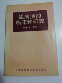 银屑病的临床和研究