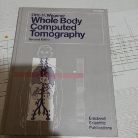 Whole Body Computed Tomography(全身计算机断层扫描)