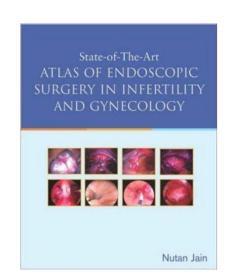 State of the Art Atlas of Endoscopic Surgery in Infertility and Gynecology (不孕症和妇科内镜手术的最新进展)