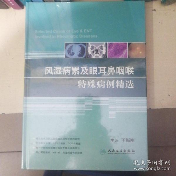 风湿病累及眼耳鼻咽喉特殊病例精选