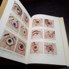 梅氏眼科学（精装本后附彩图）1956年5月新1版第1次印刷（上海版〕仅印4100册内含书签一枚【白羽画印】