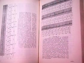 临床心电图学